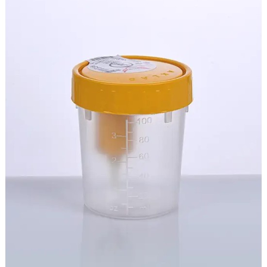 İDRAR KABI VAKUMLU ENTEGRE 100 ML